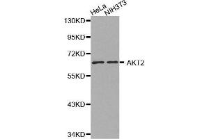 Western Blotting (WB) image for anti-V-Akt Murine Thymoma Viral Oncogene Homolog 2 (AKT2) antibody (ABIN3020945) (AKT2 抗体)