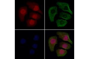 ABIN7094583 and ABIN7098632 staining Hela cells by IF/ICC. (Septin 4 抗体  (Internal Region))