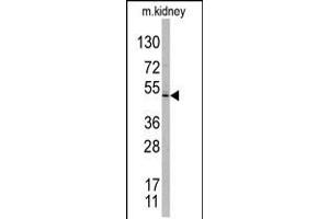Western blot analysis of TASP1 C-term polyclonal antibody in mouse kidney tissue lysates. (TASP1 抗体  (C-Term))