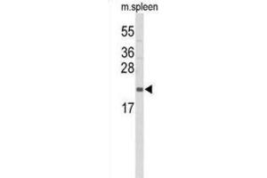 Western Blotting (WB) image for anti-Interleukin 31 (IL31) antibody (ABIN3004157) (IL-31 抗体)