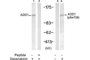 Image no. 2 for anti-Adducin 1 (Alpha) (ADD1) (pSer726) antibody (ABIN196918)