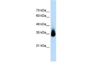 WB Suggested Anti-HOXC9 Antibody Titration:  2. (HOXC9 抗体  (N-Term))