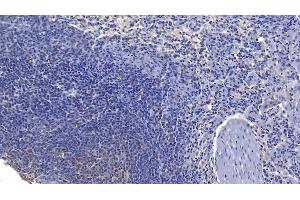 Detection of FASL in Human Spleen Tissue using Polyclonal Antibody to Factor Related Apoptosis Ligand (FASL) (FASL 抗体  (AA 102-280))