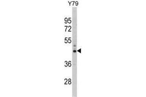 Western blot analysis of PSMD13 Antibody (C-term) in Y79 cell line lysates (35ug/lane). (PSMD13 抗体  (C-Term))