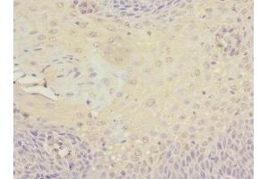 Immunohistochemistry of paraffin-embedded human tonsil tissue using ABIN7165801 at dilution of 1:100 (SRF 抗体  (AA 616-875))