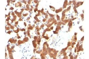 Immunohistochemistry (IHC) image for anti-Keratin 18 (KRT18) antibody (ABIN6939932)