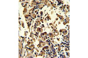 Immunohistochemistry (IHC) image for anti-Superoxide Dismutase 3, Extracellular (SOD3) antibody (ABIN3002849)