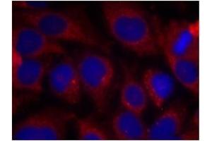 Image no. 2 for anti-SHC (Src Homology 2 Domain Containing) Transforming Protein 1 (SHC1) (Tyr427) antibody (ABIN197590)