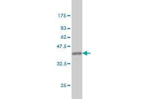 Western Blotting (WB) image for anti-ADP-Ribosylation Factor 5 (ARF5) (AA 81-180) antibody (ABIN559926)