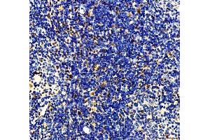 IHC analysis of MTA2 using anti-MTA2 antibody (ABIN7599519). (MTA2 抗体  (AA 1-668))