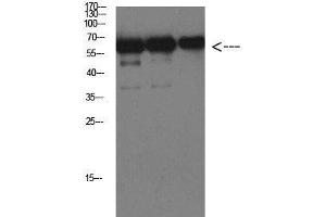 Western Blot analysis of Luciferase protein using Luciferase Monoclonal Antibody at dilution of 1:1000. (Luciferase 抗体)