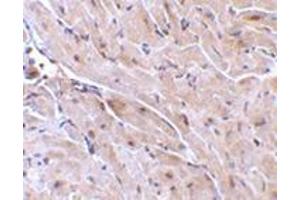 Immunohistochemistry of TRIAD3A in mouse heart with this product at 10 μg/ml. (RNF216 抗体  (N-Term))