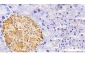 Immunohistochemistry (IHC) image for anti-Secretagogin, EF-Hand Calcium Binding Protein (SCGN) (AA 1-276) antibody (ABIN7436366)