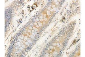 ABIN6263814 and ABIN6272376 at 1/100 staining human normal colon tissue by IHC-P.