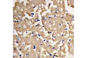 IHC analysis of FFPE heart tissue stained with LC3A antibody.