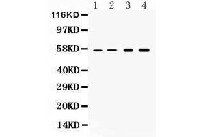 Western blot analysis of Cytokeratin 18 expression in rat liver extract ( Lane 1), mouse liver extract ( Lane 2), HELA whole cell lysates ( Lane 3) and HEPG2 whole cell lysates ( Lane 4). (Cytokeratin 18 抗体  (AA 204-430))