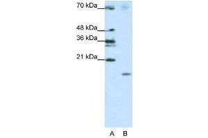 WB Suggested Anti-SRP19  Antibody Titration: 1. (SRP19 抗体  (Middle Region))