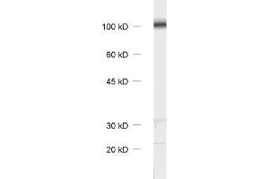 Western Blotting (WB) image for anti-Catenin, beta (CATNB) (AA 768-782) antibody (ABIN1742544) (beta Catenin 抗体  (AA 768-782))
