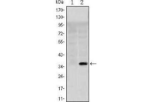 Western blot analysis using SLC22A1 mAb against HEK293 (1) and SLC22A1(AA: 284-347)-hIgGFc transfected HEK293 (2) cell lysate. (SLC22A1 抗体)