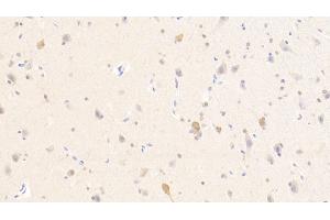 Detection of PURA in Human Cerebellum Tissue using Polyclonal Antibody to Purine Rich Element Binding Protein A (PURA) (PURA 抗体  (AA 1-322))