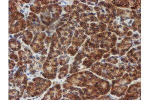 Image no. 9 for anti-Sec1 Family Domain Containing 1 (SCFD1) antibody (ABIN1500818)