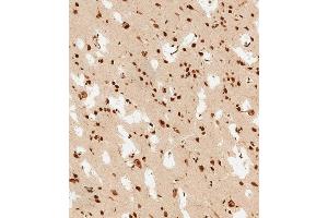 Immunohistochemistry (Paraffin-embedded Sections) (IHC (p)) image for anti-Proteasome (Prosome, Macropain) 26S Subunit, Non-ATPase, 3 (PSMD3) (AA 482-515) antibody (ABIN6243826)