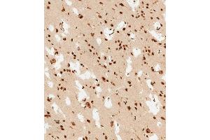 (ABIN6243826 and ABIN6578813) staining PSMD3 in human brain tissue sections by Immunohistochemistry (IHC-P - paraformaldehyde-fixed, paraffin-embedded sections). (PSMD3 抗体  (AA 482-515))