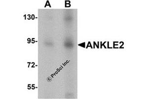 Western Blotting (WB) image for anti-Ankyrin Repeat and LEM Domain Containing 2 (ANKLE2) (Middle Region) antibody (ABIN1030852) (ANKLE2 抗体  (Middle Region))