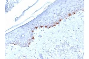 Formalin-fixed, paraffin-embedded human Skin stained with TYRP1-Monospecific Mouse Monoclonal Antibody (TYRP1/1986). (Tyrosinase-Related Protein 1 抗体  (AA 257-377))