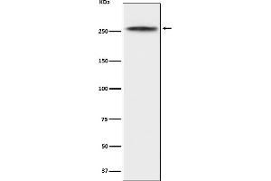 Western blot analysis of CHD3 expression in K562 cell lysate. (Recombinant CHD3 抗体)