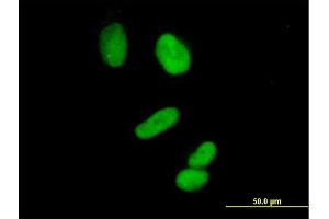 Immunofluorescence of purified MaxPab antibody to CCNH on HeLa cell. (Cyclin H 抗体  (AA 1-323))