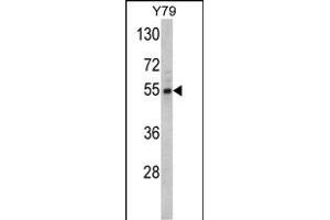 Western blot analysis of Fascin Antibody (Center) (ABIN390697 and ABIN2840983) in Y79 cell line lysates (35 μg/lane). (Fascin 抗体  (AA 322-350))