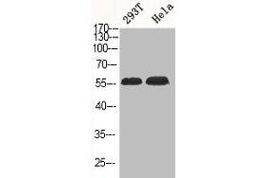 Western Blot analysis of 293T HELA cells using Phospho-Akt1/3 (Y437/434) Polyclonal Antibody (AKT1/3 (pTyr434), (pTyr437) 抗体)