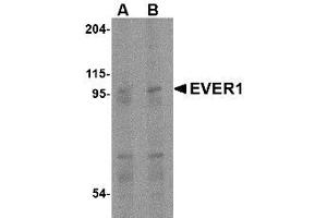 Image no. 1 for anti-Transmembrane Channel-Like 6 (TMC6) (Internal Region) antibody (ABIN1493617) (TMC6 抗体  (Internal Region))