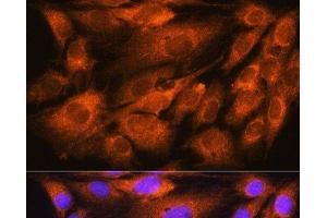 Immunofluorescence analysis of C6 cells using ATP5D Polyclonal Antibody at dilution of 1:100. (ATP5F1D 抗体)