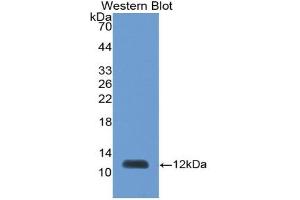 Western blot analysis of the recombinant protein. (PEX2 抗体  (AA 233-305))