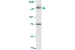 EEA1 polyclonal antibody (A01), Lot # 060717JCS1. (EEA1 抗体  (AA 1312-1411))