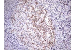 Immunohistochemistry (IHC) image for anti-Achalasia, Adrenocortical Insufficiency, Alacrimia (AAAS) (AA 322-546) antibody (ABIN2715861) (Adracalin 抗体  (AA 322-546))