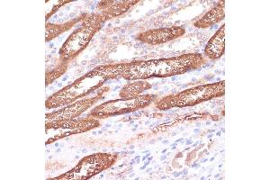 Immunohistochemistry of paraffin-embedded rat kidney using GEMIN5 antibody (ABIN7267367) at dilution of 1:100 (40x lens). (GEMIN5 抗体  (AA 750-950))