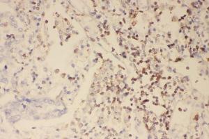 IHC analysis of Profilin 1 using anti-Profilin 1 antibody (ABIN3043603).