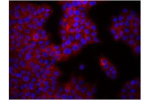 Image no. 1 for anti-Integrin beta 1 (ITGB1) antibody (ABIN205424) (ITGB1 抗体)