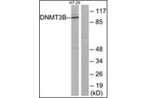 Western blot analysis of extracts from HT-29 cells, using DNMT3B Antibody. (DNMT3B 抗体  (N-Term))