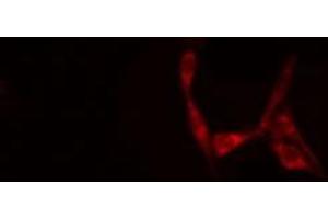 ABIN6277707 staining Hela cells by IF/ICC. (SH3G2 抗体  (Internal Region))