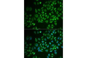 Immunofluorescence analysis of A549 cells using GPLD1 antibody (ABIN5973975). (GPLD1 抗体)
