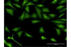 Immunofluorescence of monoclonal antibody to DCP1A on HeLa cell. (DCP1A 抗体  (AA 186-285))