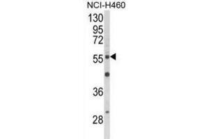 Western Blotting (WB) image for anti-V-Akt Murine Thymoma Viral Oncogene Homolog 2 (AKT2) antibody (ABIN5022918) (AKT2 抗体)