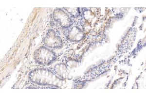 Detection of HRG in Rat Small intestine Tissue using Monoclonal Antibody to Histidine Rich Glycoprotein (HRG) (HRG 抗体  (AA 19-525))