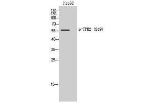 Western Blotting (WB) image for anti-Tryptophan Hydroxylase 2 (TPH2) (pSer19) antibody (ABIN3182390) (Tryptophan Hydroxylase 2 抗体  (pSer19))