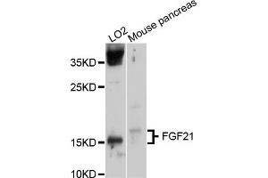 Western blot analysis of extracts of various cell lines, using FGF21 antibody. (FGF21 抗体)