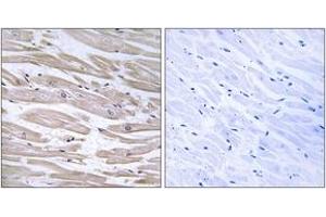 Immunohistochemistry (IHC) image for anti-DnaJ (Hsp40) Homolog, Subfamily B, Member 11 (DNAJB11) (AA 31-80) antibody (ABIN1534851)